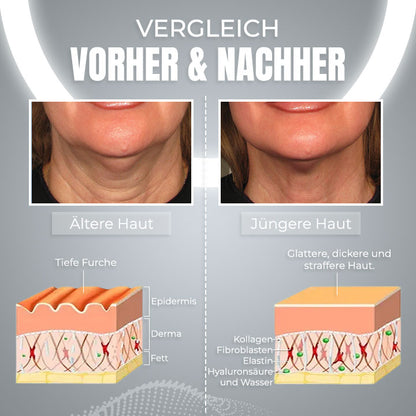 EMS Schlafendes V-Gesicht Schönheitsgerät