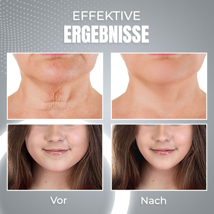 EMS Schlafendes V-Gesicht Schönheitsgerät