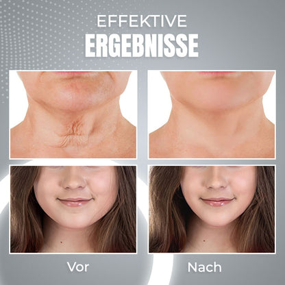 EMS Schlafendes V-Gesicht Schönheitsgerät