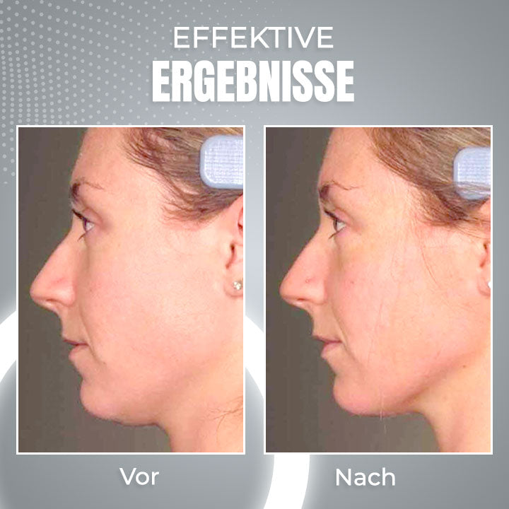 EMS Schlafendes V-Gesicht Schönheitsgerät