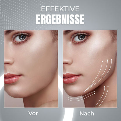 EMS Schlafendes V-Gesicht Schönheitsgerät